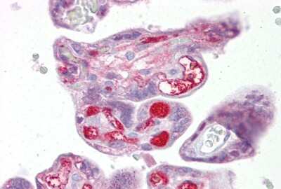 Immunohistochemistry-Paraffin: SLC26A4 Antibody [NBP1-60106]