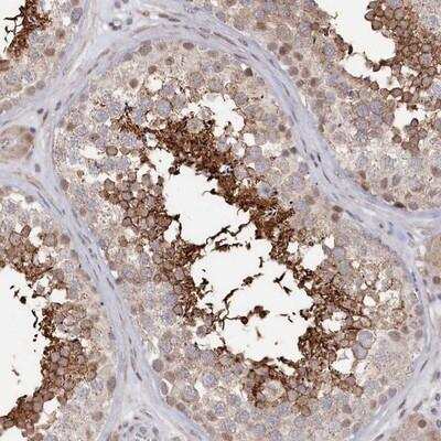 Immunohistochemistry: SLC26A8 Antibody [NBP1-87419]