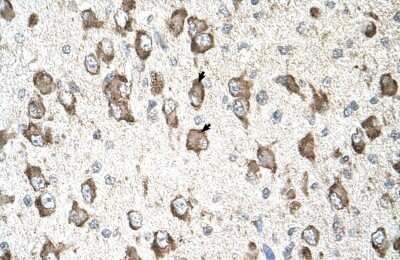 Immunohistochemistry-Paraffin: SLC26A8 Antibody [NBP1-70717]