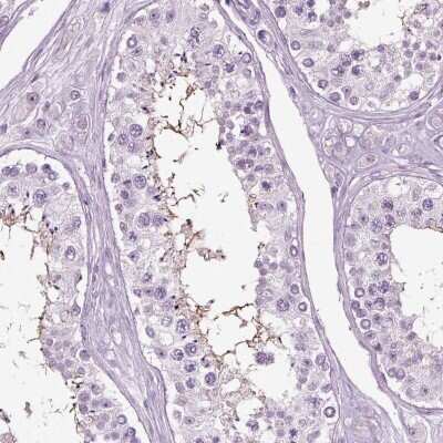 Immunohistochemistry-Paraffin: SLC26A8 Antibody [NBP1-87419]