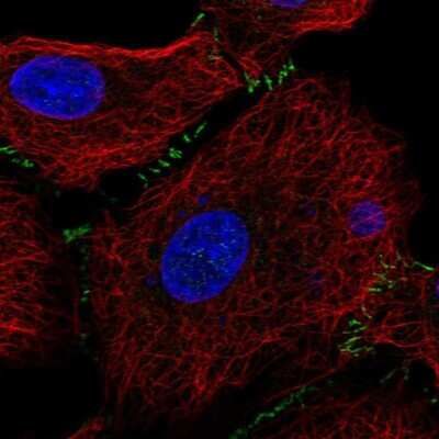 Immunocytochemistry/ Immunofluorescence: SLC26A9 Antibody [NBP2-30425]