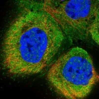 Immunocytochemistry/ Immunofluorescence: SLC28A1 Antibody [NBP3-17620]