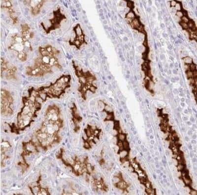 Immunohistochemistry-Paraffin: SLC28A1 Antibody [NBP2-30857]