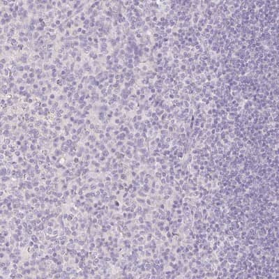 Immunohistochemistry-Paraffin: SLC28A1 Antibody [NBP2-30857]