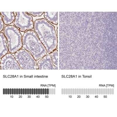 Immunohistochemistry-Paraffin: SLC28A1 Antibody [NBP2-30857]