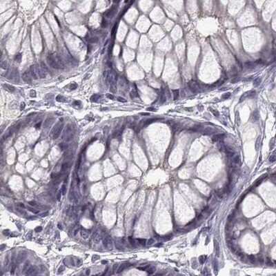 Immunohistochemistry-Paraffin: SLC28A2 Antibody [NBP2-38763]