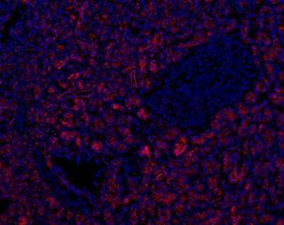 Immunohistochemistry: SLC28A3 Antibody [NBP1-84418]
