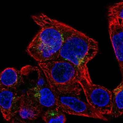 Immunocytochemistry/ Immunofluorescence: SLC29A3 Antibody [NBP2-58230]