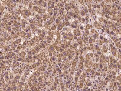 Immunohistochemistry-Paraffin: SLC2A7 Antibody [NBP2-98131]