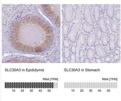 Immunohistochemistry-Paraffin: SLC30A3 Antibody [NBP2-31825]
