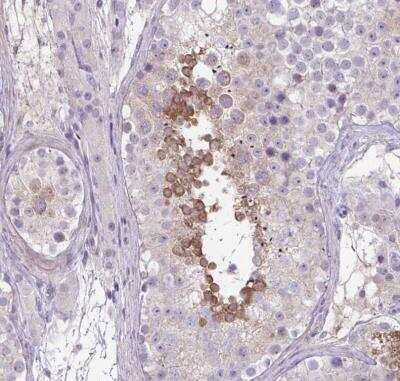 Immunohistochemistry-Paraffin: SLC30A3 Antibody [NBP2-31825]