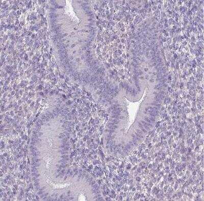 Immunohistochemistry-Paraffin: SLC30A3 Antibody [NBP2-31825]