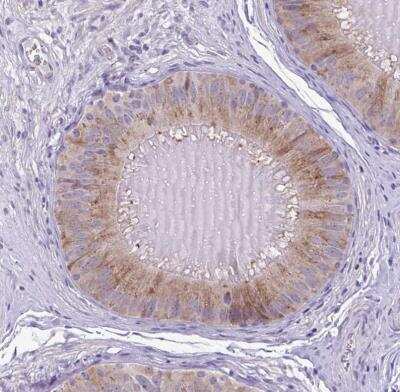 Immunohistochemistry-Paraffin: SLC30A3 Antibody [NBP2-31825]