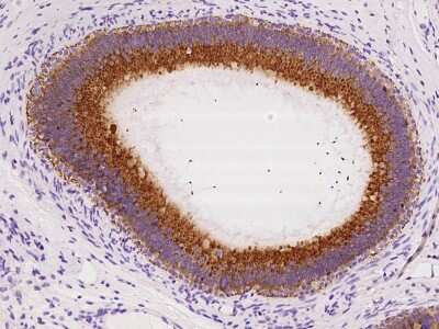 Immunohistochemistry-Paraffin: SLC30A3 Antibody [NBP2-97660]