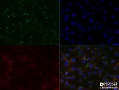 Immunocytochemistry/ Immunofluorescence: SLC31A1/CTR1 Antibody (5E6.1B4) - Azide and BSA Free [NBP2-80951]