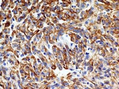 Immunohistochemistry-Paraffin: SLC31A1/CTR1 Antibody (5E6.1B4) - Azide and BSA Free [NBP2-80951]