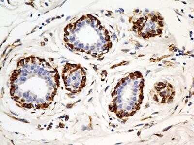 Immunohistochemistry-Paraffin: SLC31A1/CTR1 Antibody (5E6.1B4) - Azide and BSA Free [NBP2-80951]