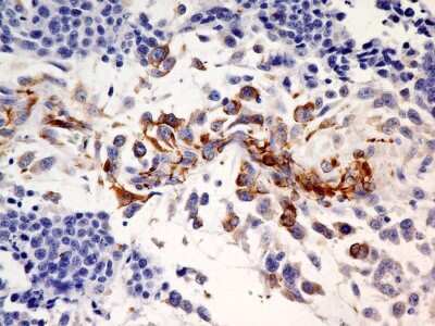 Immunohistochemistry-Paraffin: SLC31A1/CTR1 Antibody (5E6.1B4) - BSA Free [NBP2-36573]