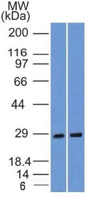 Western Blot: SLC31A1/CTR1 Antibody (5E6.1B4)BSA Free [NBP2-36573]