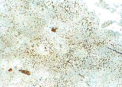 Immunohistochemistry-Paraffin: SLC31A1/CTR1 Antibody [NBP3-12348]