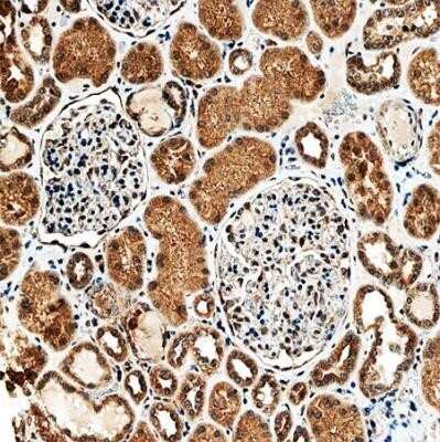 Immunohistochemistry: SLC34A1 Antibody (10B1.3E9) - Azide and BSA Free [NBP2-80953]