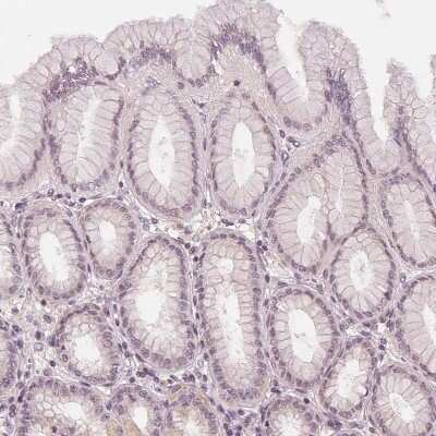 Immunohistochemistry-Paraffin: SLC34A1 Antibody [NBP2-13328]