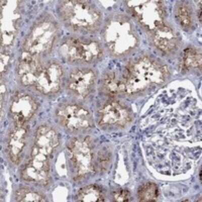 Immunohistochemistry-Paraffin: SLC34A1 Antibody [NBP3-17792]