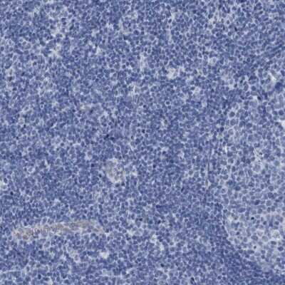 Immunohistochemistry-Paraffin: SLC34A3 Antibody [NBP1-81933]
