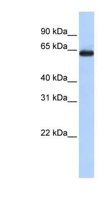 Western Blot: SLC34A3 Antibody [NBP1-79976]