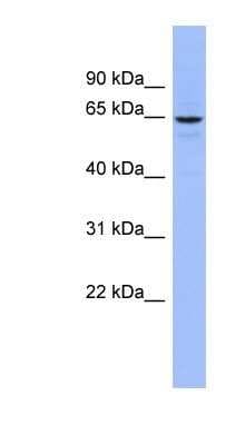 Western Blot: SLC34A3 Antibody [NBP1-79995]