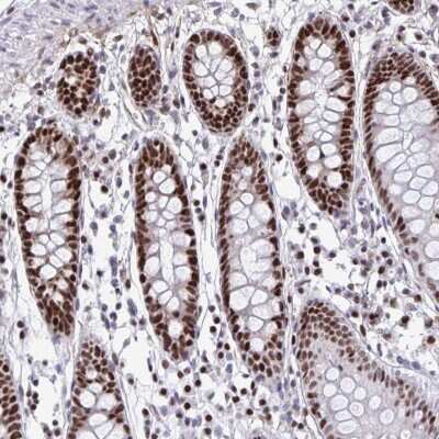 Immunohistochemistry-Paraffin: SLC35C2 Antibody [NBP2-32008]