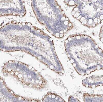 Immunohistochemistry-Paraffin: SLC35D3 Antibody [NBP1-81867]