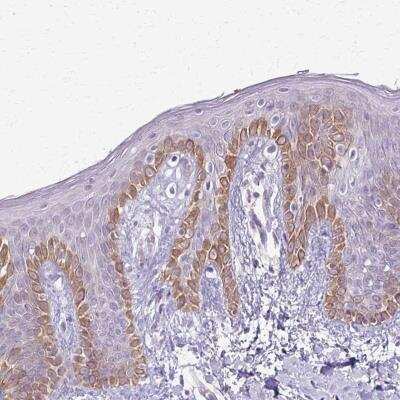 Immunohistochemistry-Paraffin: SLC35E2 Antibody [NBP2-31865]