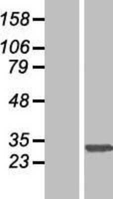Western Blot: SLC35E2 Overexpression Lysate [NBP2-04815]