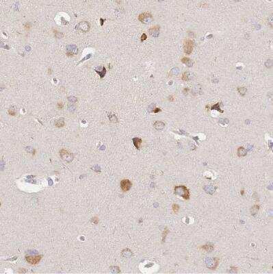 Immunohistochemistry-Paraffin: SLC35F3 Antibody [NBP2-13332]