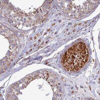 Immunohistochemistry-Paraffin: SLC35F4 Antibody [NBP1-94126]