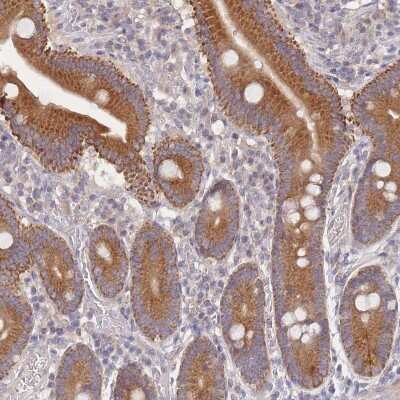 Immunohistochemistry-Paraffin: SLC35F5 Antibody [NBP2-13333]