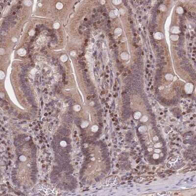 Immunohistochemistry-Paraffin: SLC35F5 Antibody [NBP2-13334]