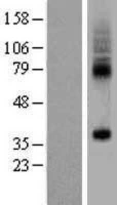 Western Blot: SLC35F5 Overexpression Lysate [NBP2-04396]
