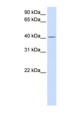 Western Blot: SLC35F6 Antibody [NBP1-91306]