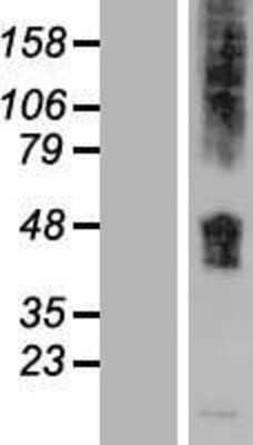 Western Blot: SLC36A1 Overexpression Lysate [NBP2-05787]