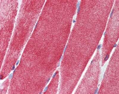 Immunohistochemistry-Paraffin: SLC36A2 Antibody [NBP1-59418]