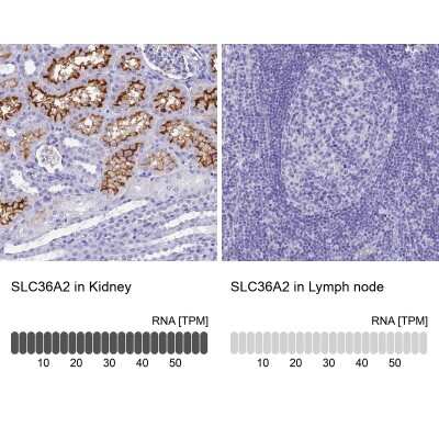 Immunohistochemistry-Paraffin: SLC36A2 Antibody [NBP1-92401]