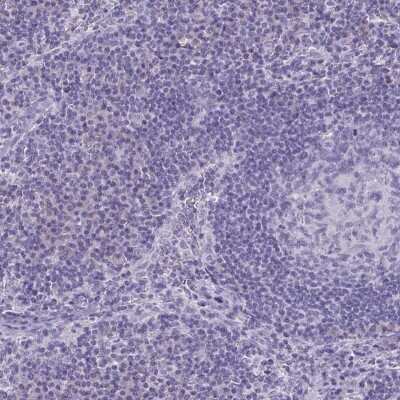 Immunohistochemistry-Paraffin: SLC36A2 Antibody [NBP2-49360]