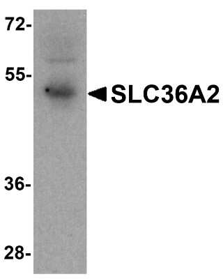 Western Blot: SLC36A2 AntibodyBSA Free [NBP2-81904]