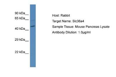 Western Blot: SLC36A4 Antibody [NBP2-88302]