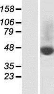 Western Blot: SLC37A2 Overexpression Lysate [NBP2-04718]