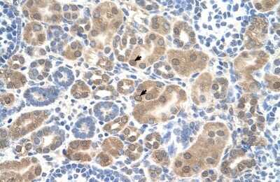 Immunohistochemistry-Paraffin: SLC38A1 Antibody [NBP1-59649]