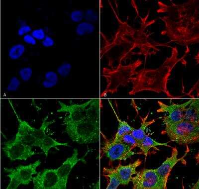 Immunocytochemistry/ Immunofluorescence: SLC38A1 Antibody (S104-32) [NBP2-59311]