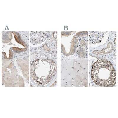 Immunohistochemistry-Paraffin: SLC38A10 Antibody [NBP1-81193]